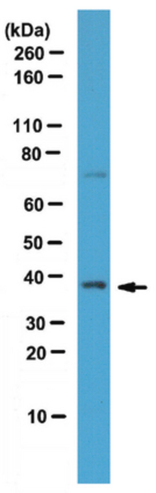 Anti-SRp40 Antibody