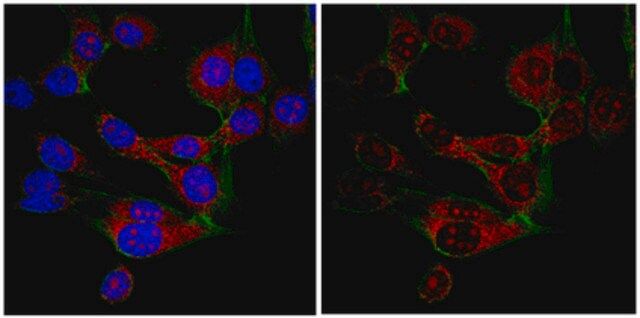 Anti-SRp30a (SF2) Antibody