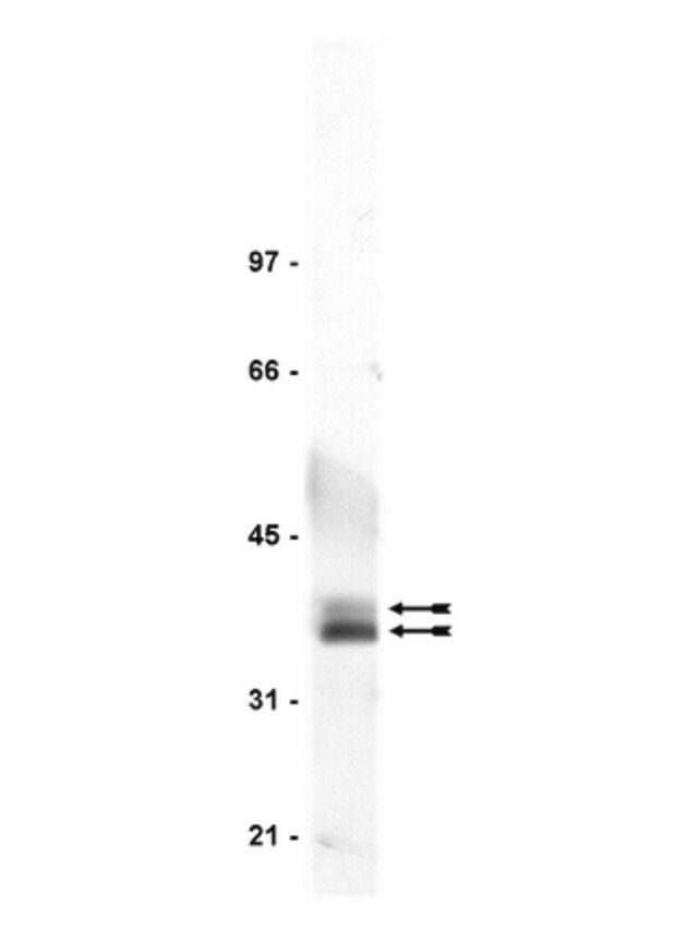 Anti-LAT Antibody