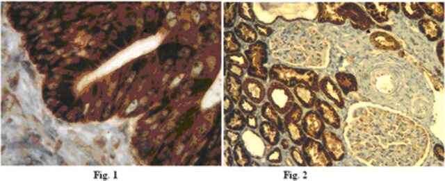 Anti-IL-13 receptor Antibody, alpha-2 (IL-13RA2)