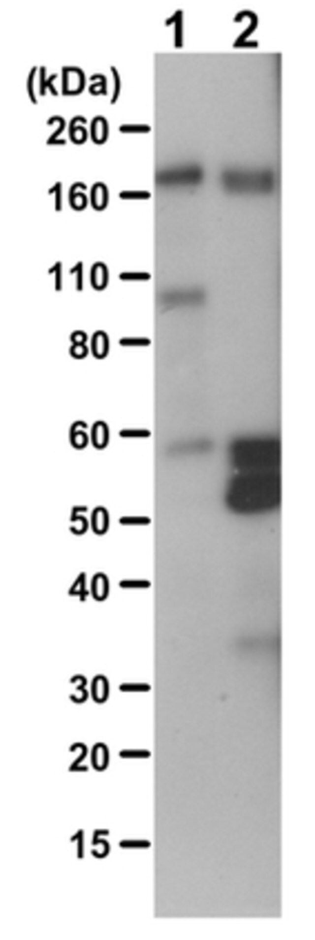 Anti-Phosphotyrosine Antibody