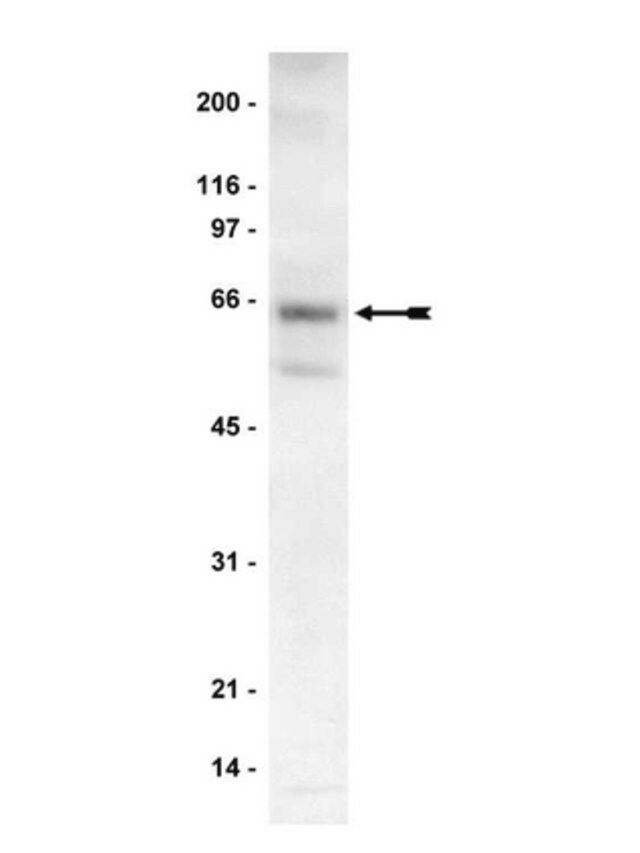 Anti-p70 S6 Kinase (S6K) Antibody