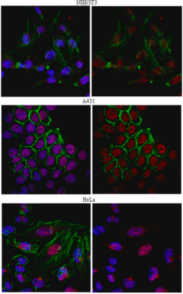 Anti-mRNA-capping enzyme Antibody