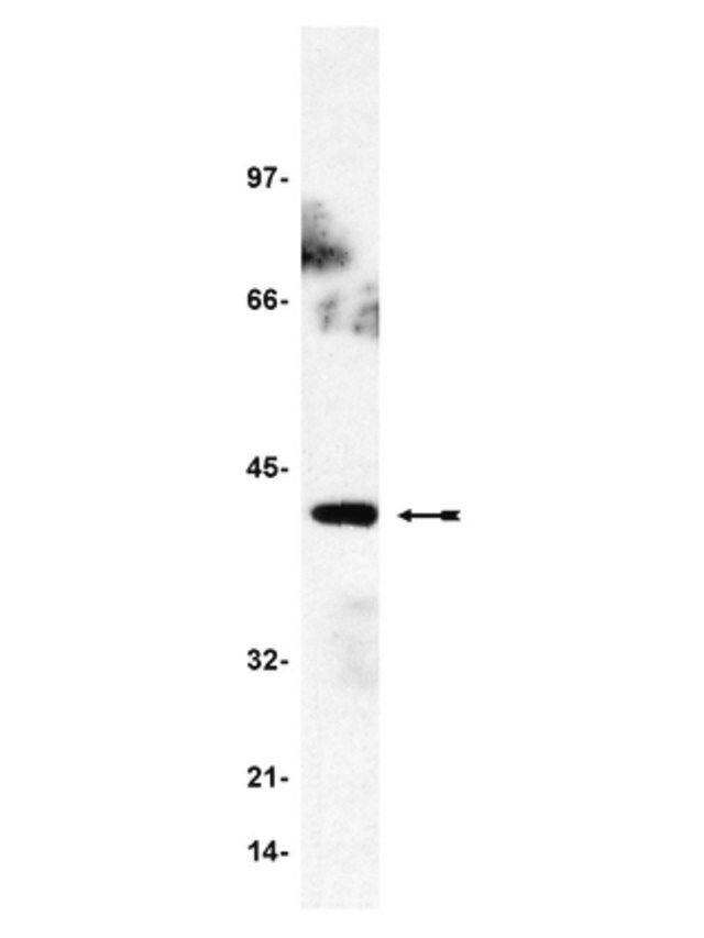 Anti-GADS Antibody