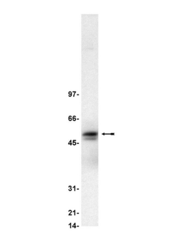 Anti-Lyn Antibody