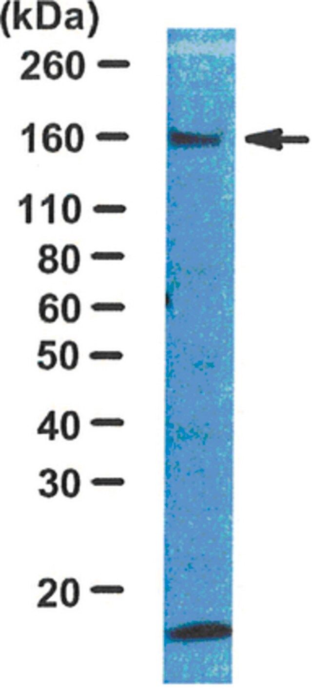 Anti-IRS1 Antibody