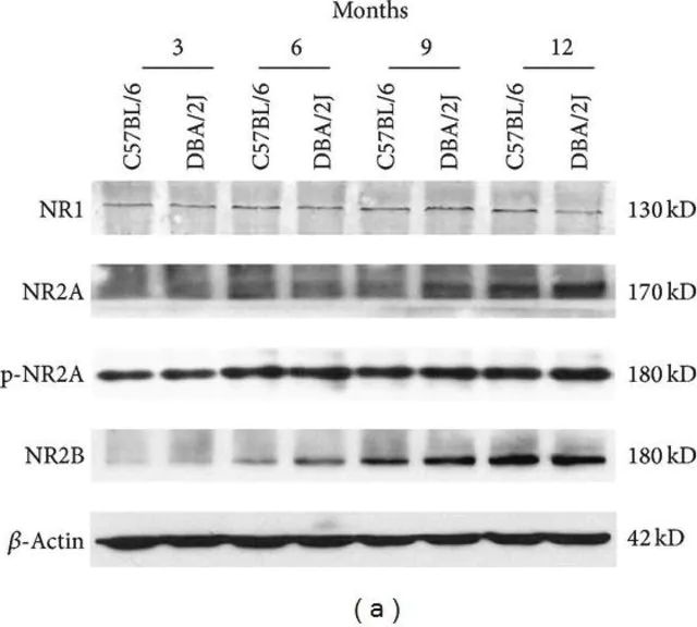 Anti-NR2B Antibody