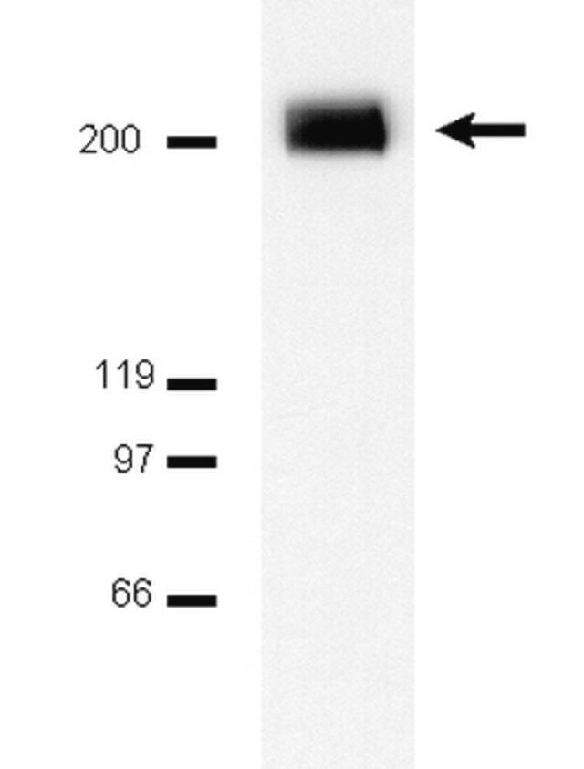 Anti-PDGFR Antibody