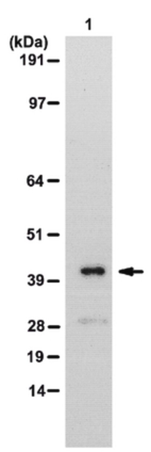 Anti-NET5 Antibody