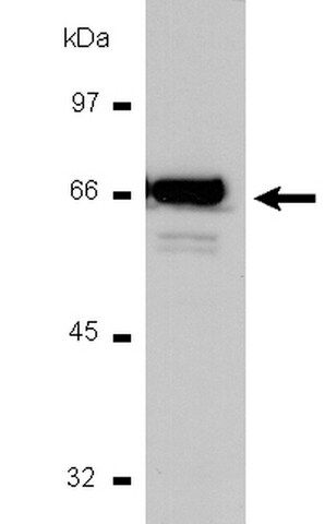 Anti-NFB p65 Antibody, CT