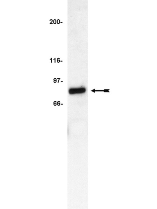 Anti-IRAK Antibody