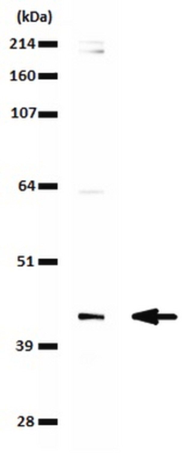 Anti-SETD8 (hPR-SET7) Antibody