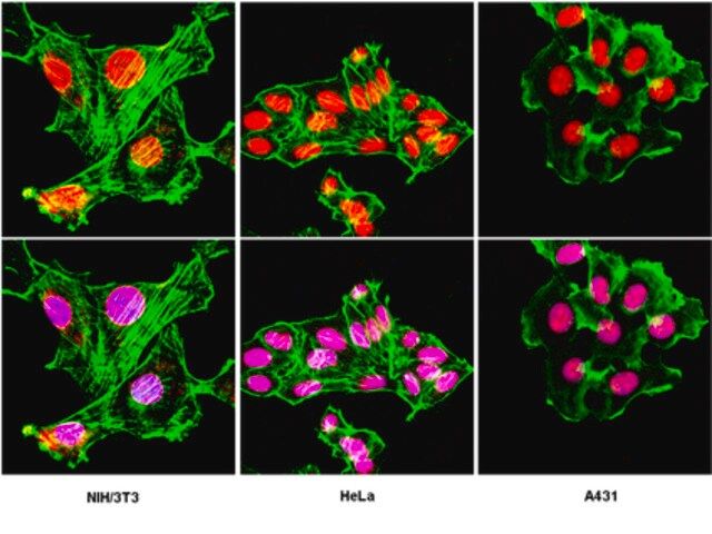 Anti-LAP2 Antibody