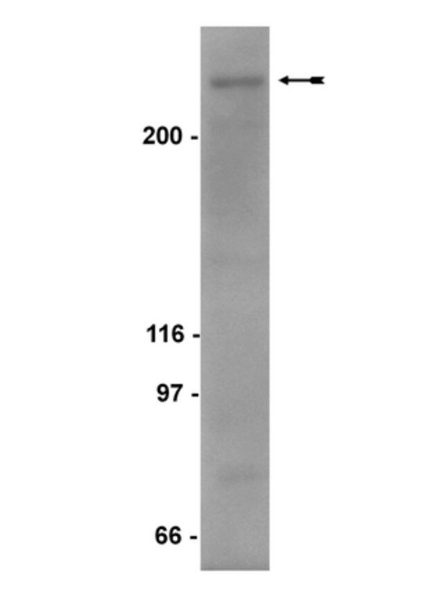 Anti-SMRTe Antibody