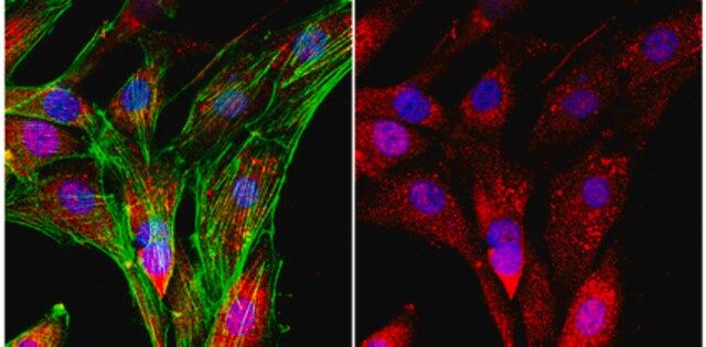 Anti-SLBP Antibody