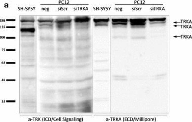 Anti-TrkA Antibody