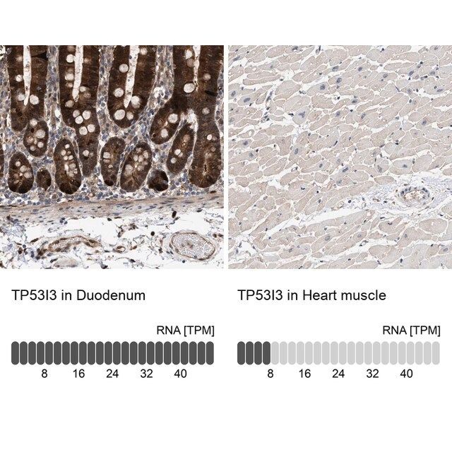 Anti-TP53I3 antibody produced in rabbit