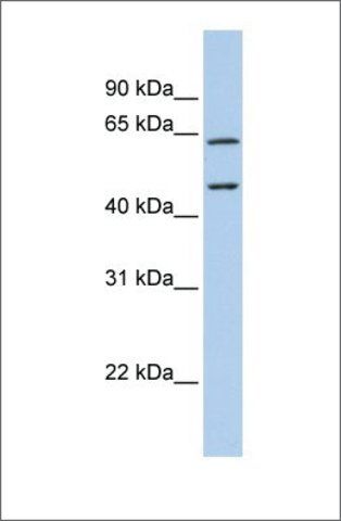 Anti-CECR1 antibody produced in rabbit