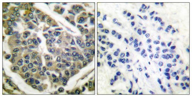 Anti-Collagen IV antibody produced in rabbit