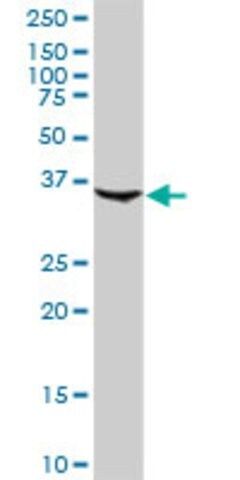 Anti-CFHR1 antibody produced in rabbit