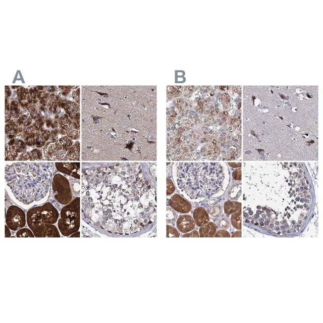 Anti-CLPB antibody produced in rabbit