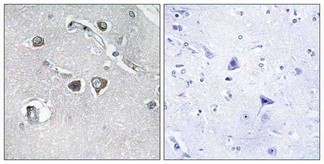 Anti-Collagen XI 2 antibody produced in rabbit