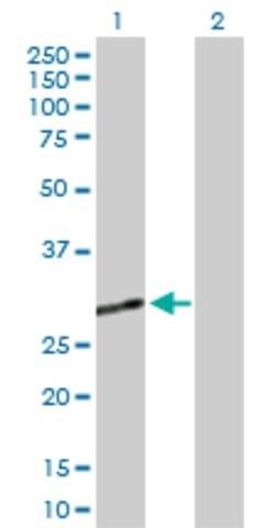 Anti-CECR1 antibody produced in rabbit