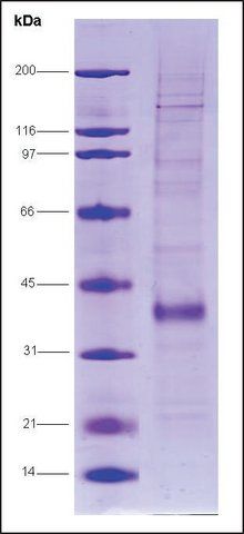 Fos-related antigen 1 human