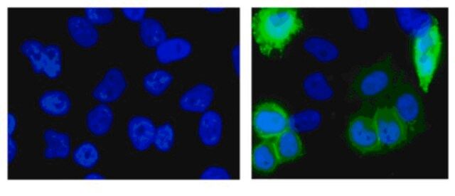 Anti-Histidine Tagged Antibody, clone HIS.H8