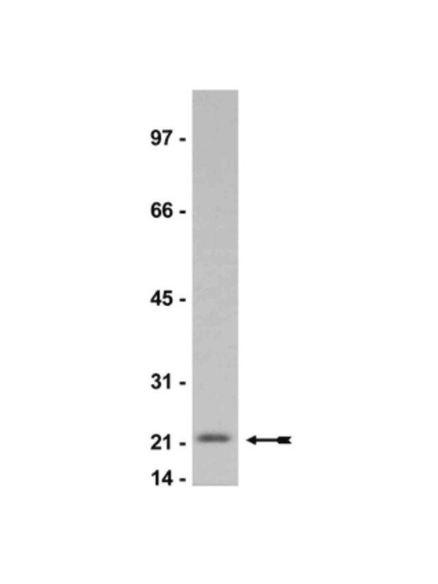 Anti-p21/WAF1/Cip1 Antibody, clone CP74