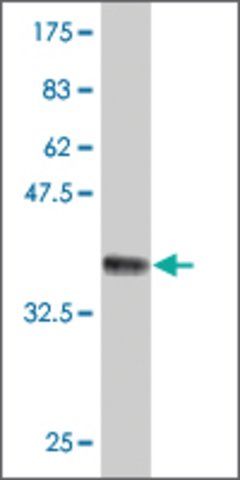 Monoclonal Anti-RKHD3 antibody produced in mouse