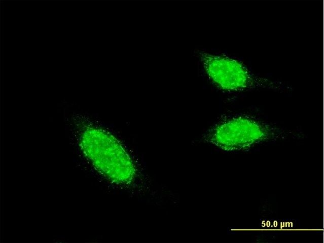 Monoclonal Anti-BRCC2 antibody produced in mouse