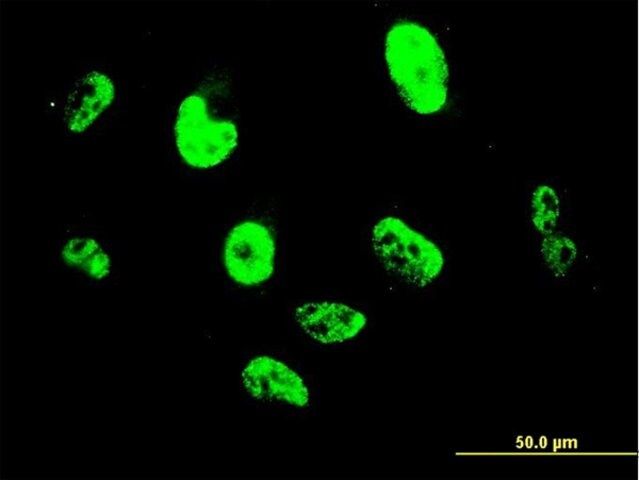 Monoclonal Anti-SNAI2 antibody produced in mouse