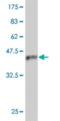 Monoclonal Anti-IRAK4 antibody produced in mouse