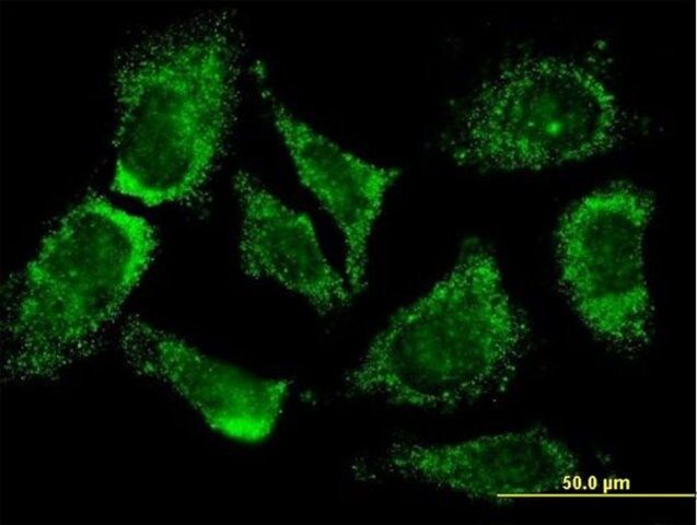 Monoclonal Anti-MOGAT3 antibody produced in mouse