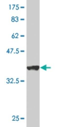 Monoclonal Anti-VDAC1 antibody produced in mouse