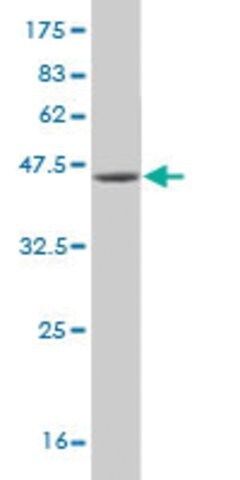 Monoclonal Anti-USP9Y antibody produced in mouse