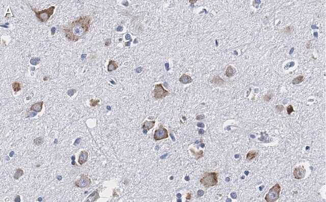 Anti-CGRP-1 Antibody, clone 2E18 ZooMAb<sup>?</sup> Rabbit Monoclonal