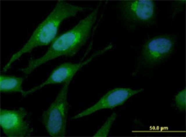 Monoclonal Anti-CTNNB1 antibody produced in mouse