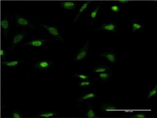 Monoclonal Anti-OLIG2 antibody produced in mouse