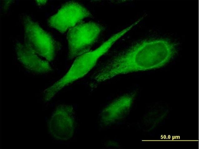 Monoclonal Anti-TBC1D8 antibody produced in mouse