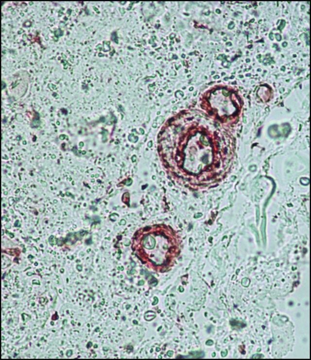 Anti--Actin antibody, Mouse monoclonal