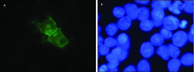 Anti-D<sub>1</sub> Dopamine Receptor antibody,Rat monoclonal antibody produced in rat