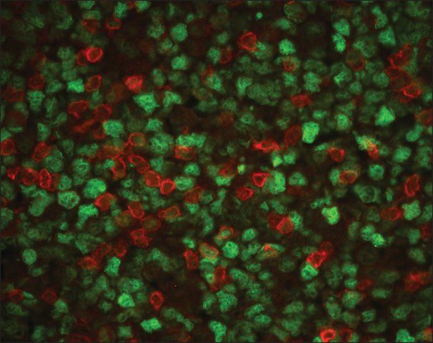 Anti-CD3, T Cell antibody produced in rabbit