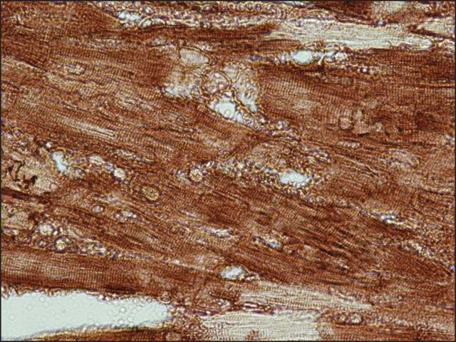 Anti-Actin, Cardiac antibody, Mouse monoclonal