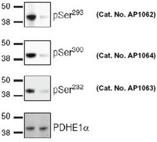 PhosphoDetect Anti-PDH-E1 (pSer<sup>3</sup><sup>0</sup><sup>0</sup>) Rabbit pAb