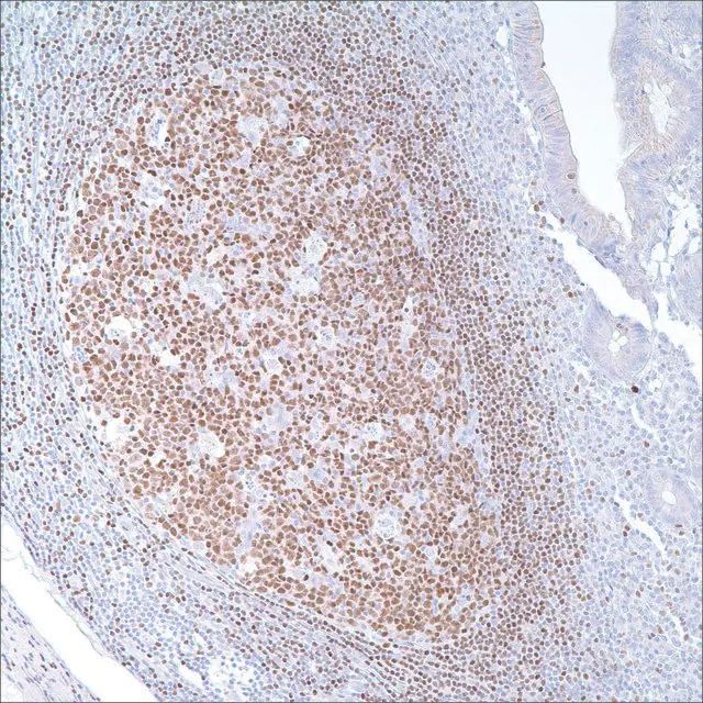 PAX-5 (24) Mouse Monoclonal Antibody