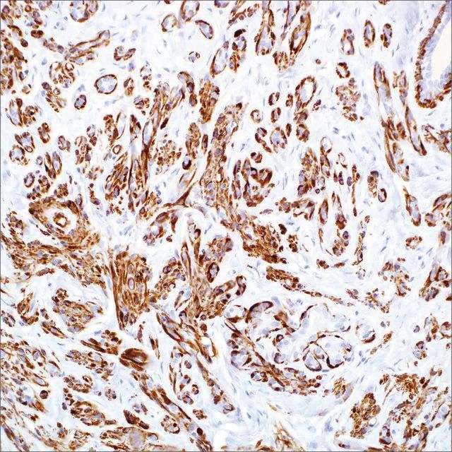 Myosin, Smooth Muscle (SMMS-1) Mouse Monoclonal Antibody