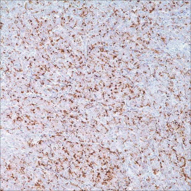 GCDFP-15 (EP1582Y) Rabbit Monoclonal Primary Antibody