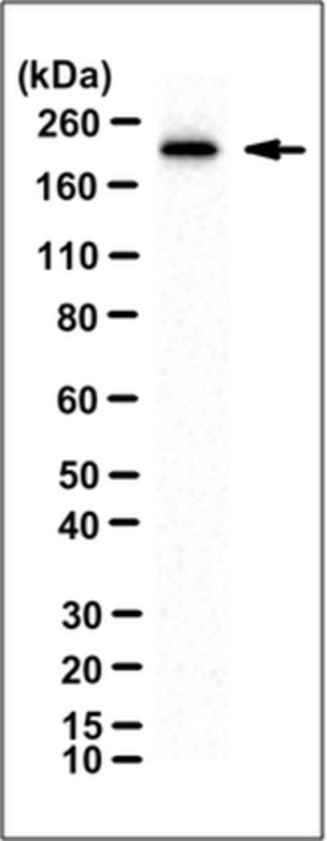 Anti-Mi-2 Antibody, clone 17H11